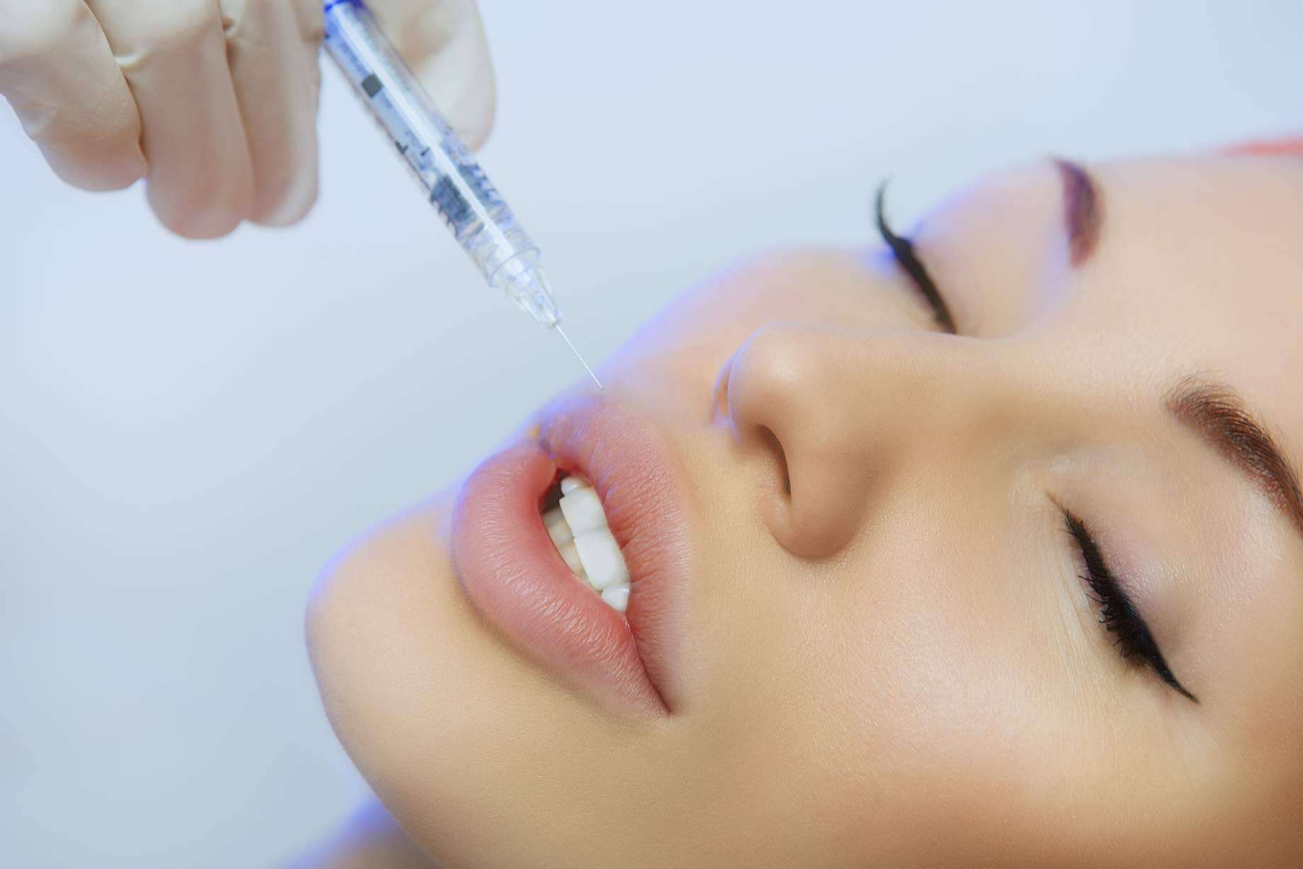 El Dr. Carlos Zito realiza el aumento de labios en Barcelona