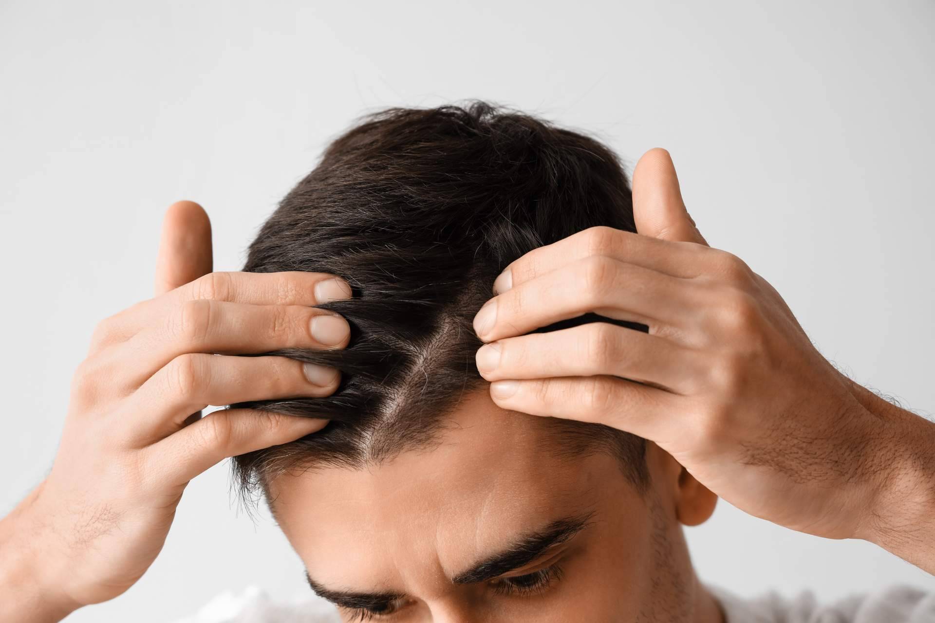 Clínica Estética SILOE, especialista en realizar el tratamiento de injerto capilar Valladolid