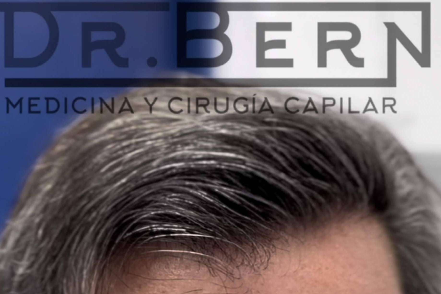 Dr. Bern lleva su técnica de FUE - DHI a distintas partes de Latinoamérica y Europa