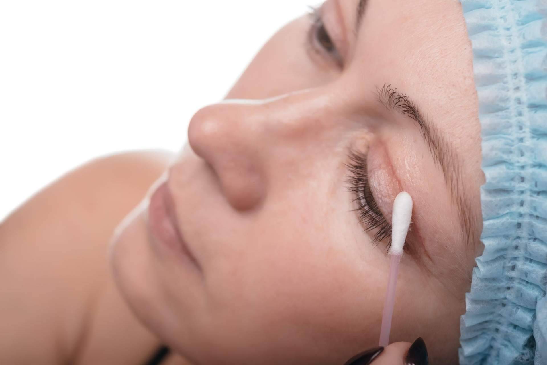 La Clinica de Medicina Estética Elegansse, referente de blefaroplastia mínimamente invasiva de Barcelona