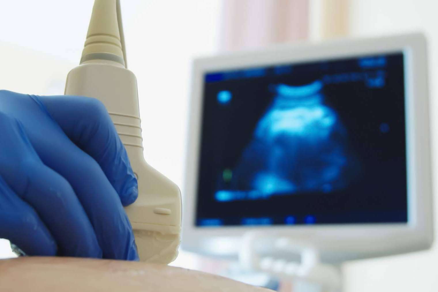 El software de ViewPoint 6 para ginecología y cardio de Health Net Connections