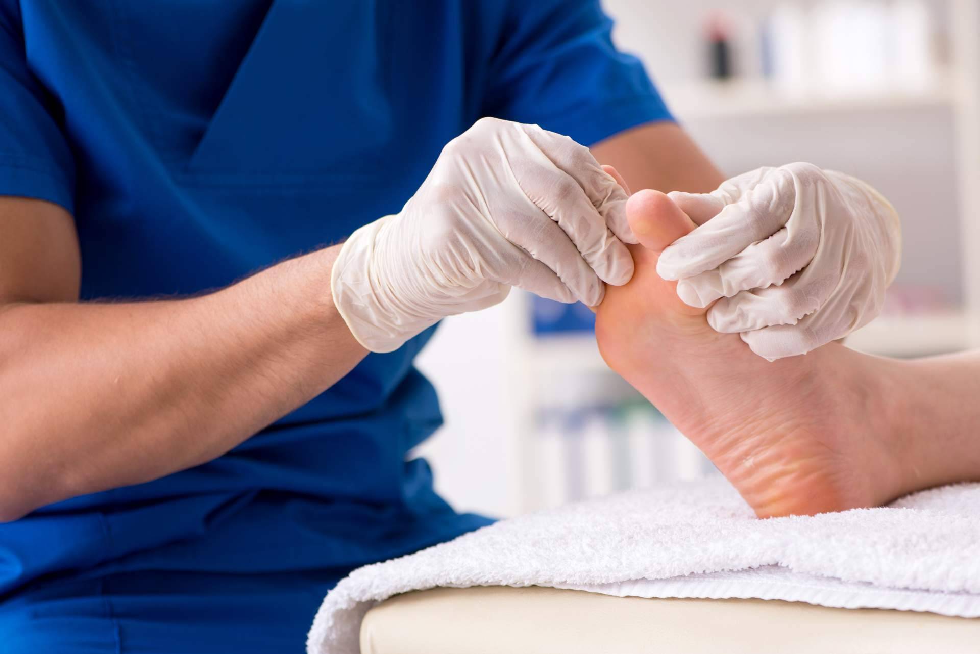 La relevancia de visitar el podólogo, soluciones y tratamientos para los hongos en los pies por Clínica de Podología Integral Pododerm