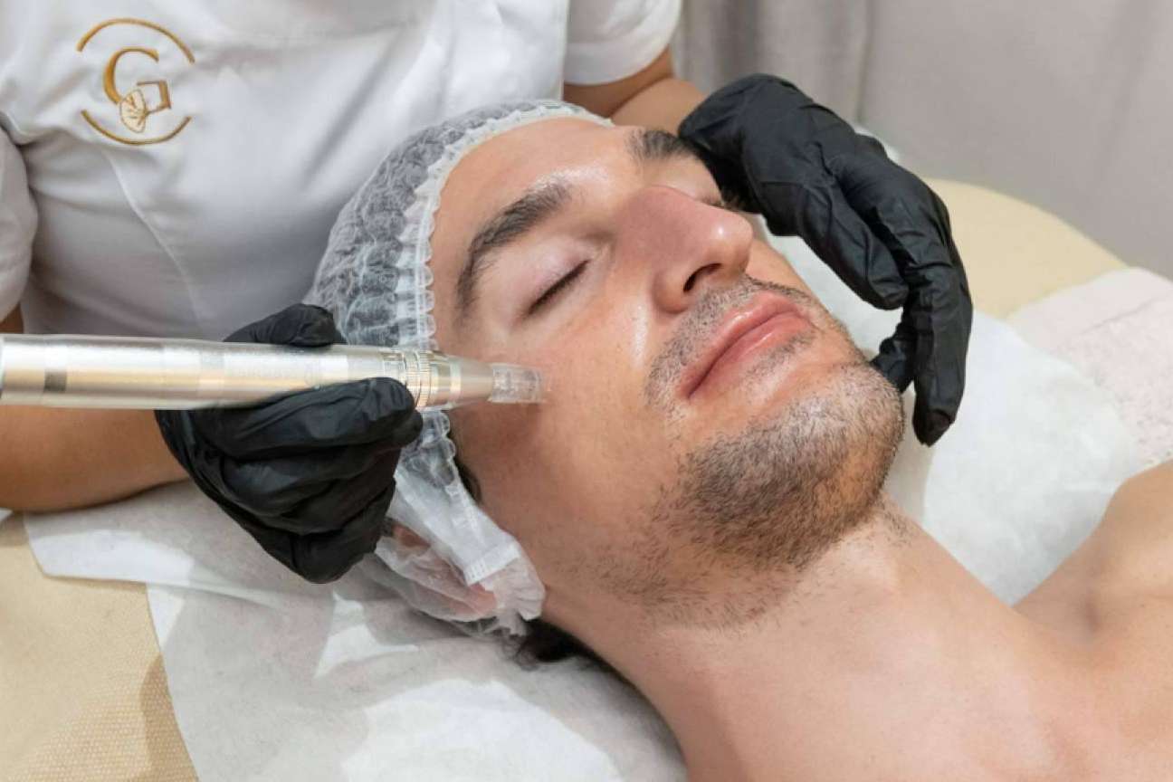 G&G Beauty ofrece un tratamiento innovador Dermapen Madrid