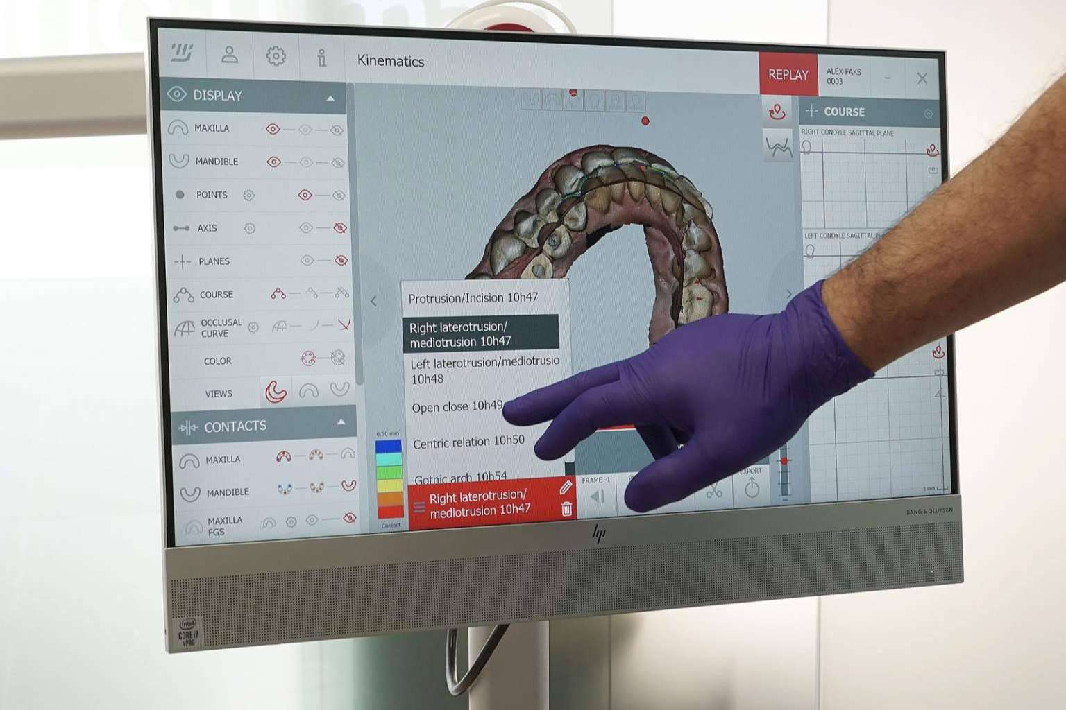 Tratamientos especializados en la Clínica Dental Darío Ulman