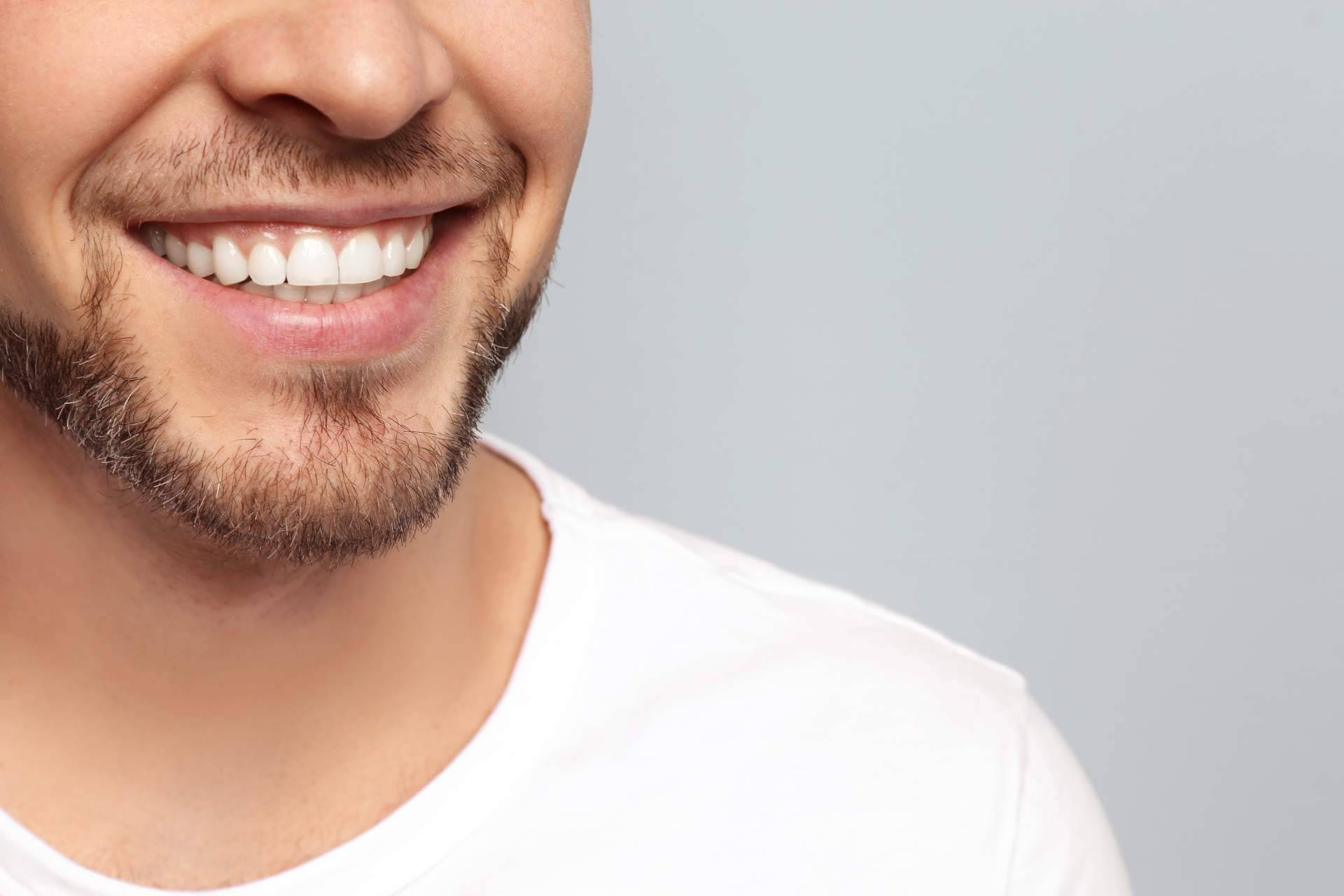 Cuáles son los beneficios de los implantes dentales de la Clínica Dental Agudo Rosa