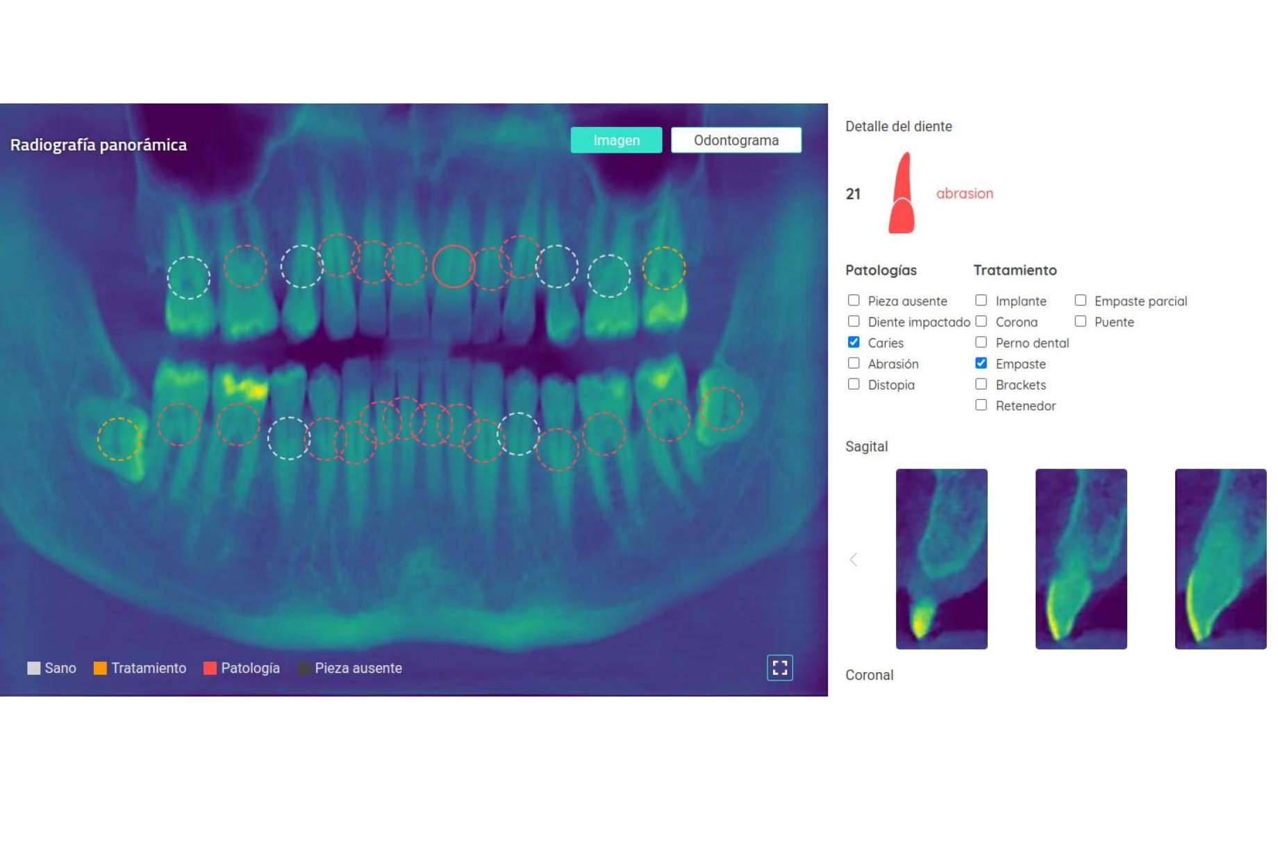 Dentomo y el uso de la visión artificial en el mundo odontológico