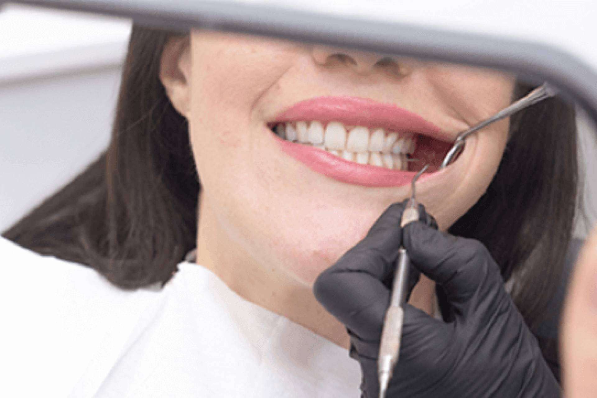 Denty Dent, especialistas en tratamientos de estética dental