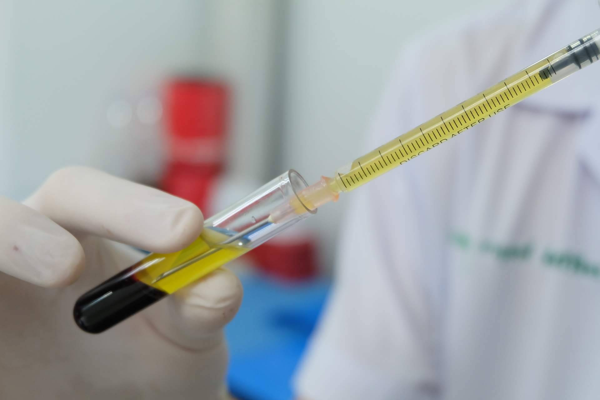 La relevancia del plasma rico en plaquetas en la traumatología