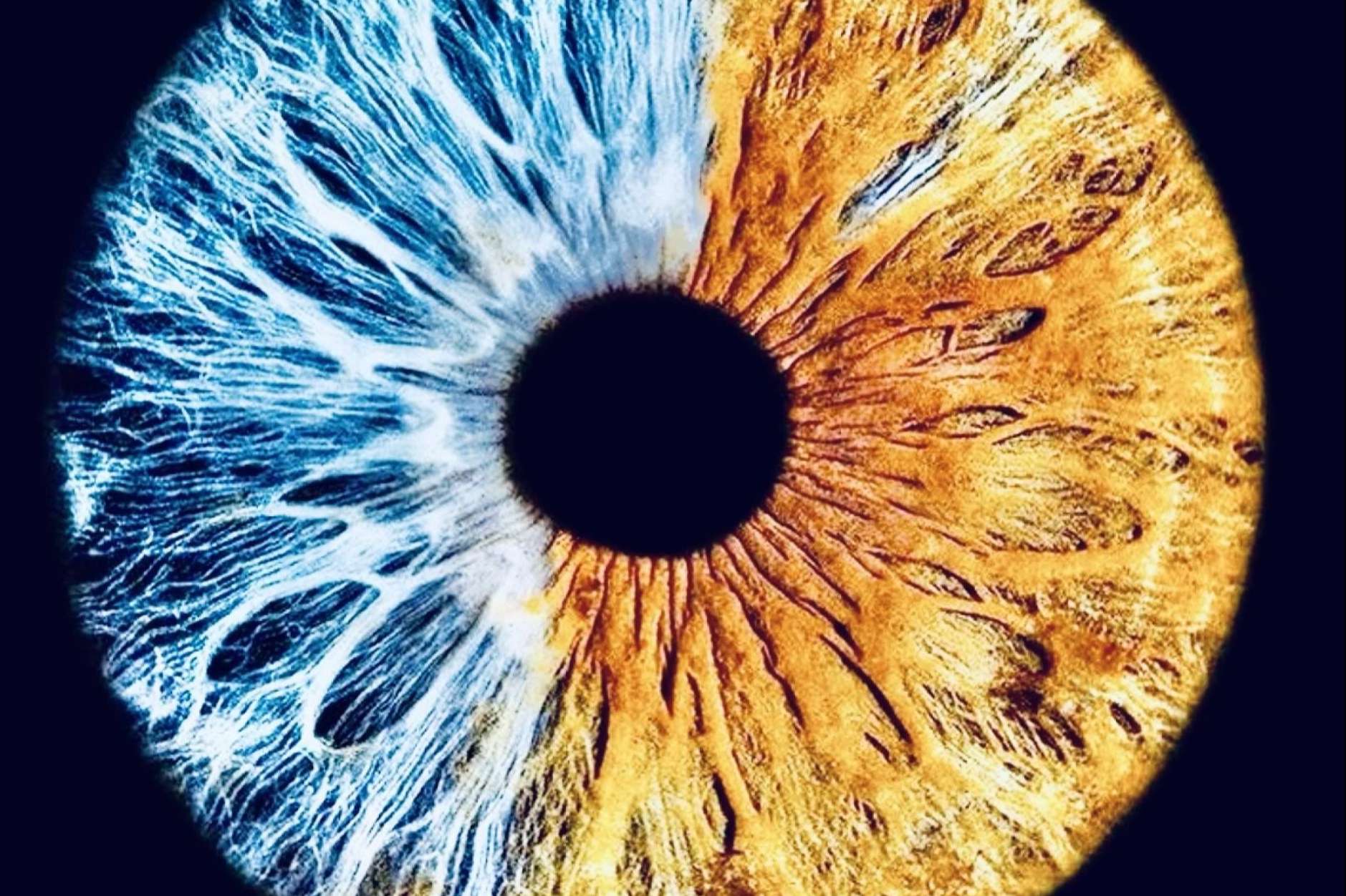 La pigmentación de los ojos se puede clasificar en 5 grados, según los expertos de Eyecos