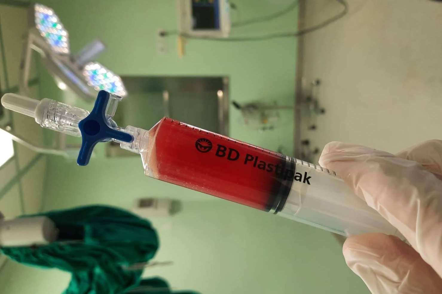 Biorigenera y sus tratamientos para el dolor de hombro