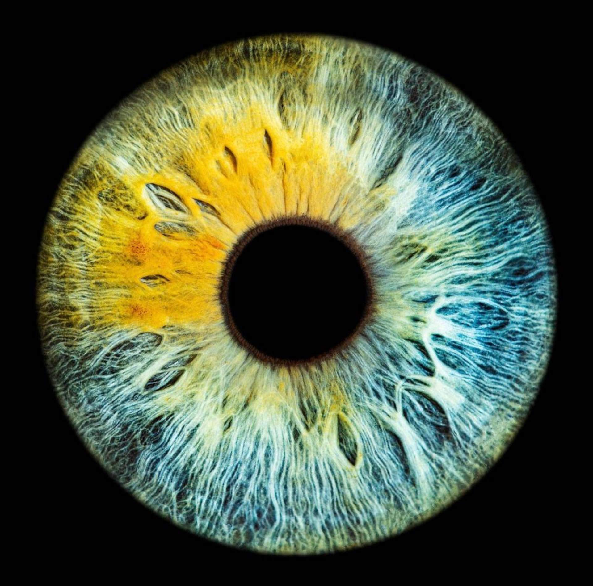 Pecas en los ojos; estas son las características de los nevus oculares